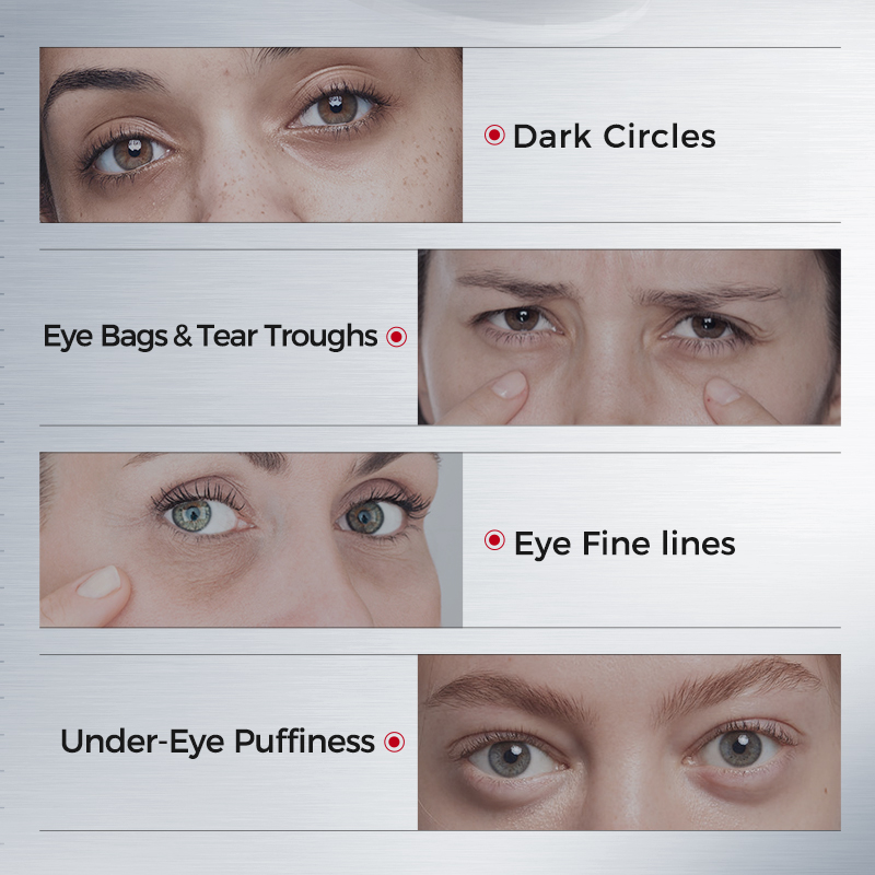 Eye Patches for Dark Circles – - Eye Pad Collagen review and price